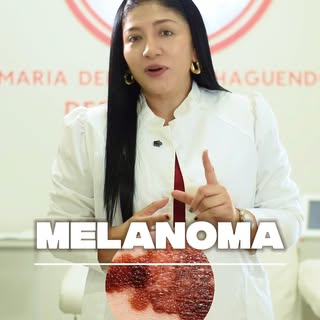 El melanoma puede parecer una simple mancha… pero detectarlo a tiempo puede salvar vidas ⚠️🩺

En De