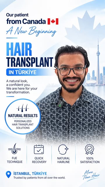 We performed a hair transplant for our patient who came from Canada🇨🇦

The Importance of Natural R