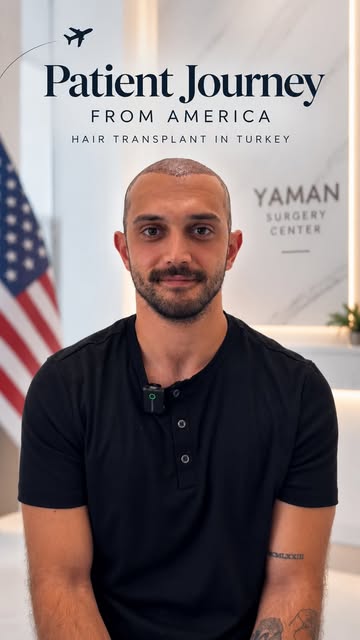 We performed a hair transplant for our patient who came from Usa🇺🇸

The Importance of Natural Resu