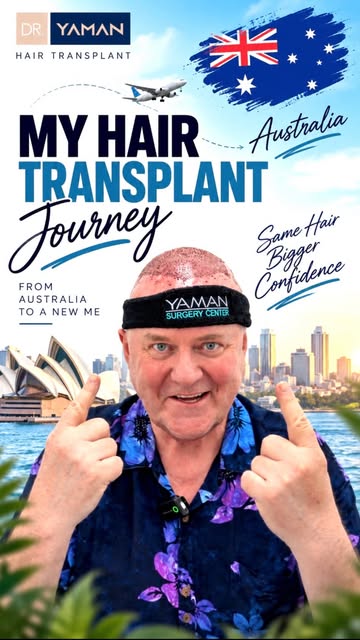 Mega session Hair transplant in Turkey-7070 Grafts

Watch how Dr. Resul Yaman restored complete cove
