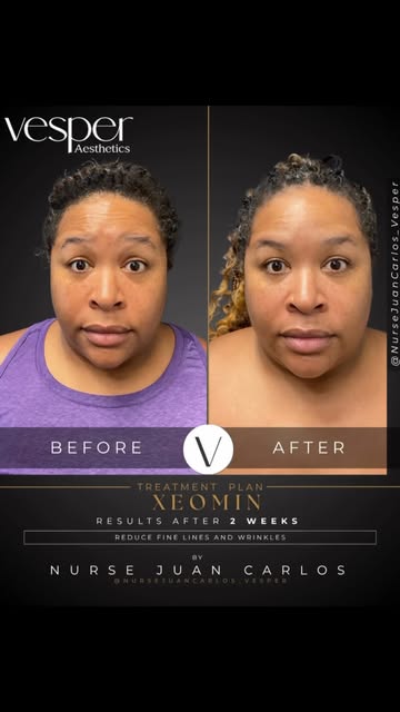 ✨ Soft. Refreshed. Still YOU. ✨

Ladies, sometimes the best beauty secret is simply looking like you