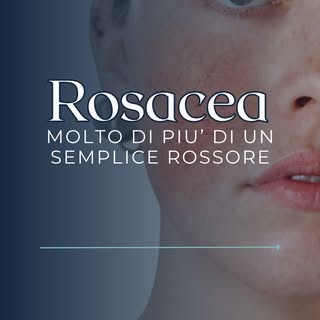 Rossore persistente, vampate improvvise, bruciore, pelle che “tira”, capillari visibili o piccoli br