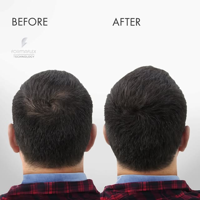 We have more than a few tricks up our sleeve! Hair thickening fibers blend seamlessly with your own 