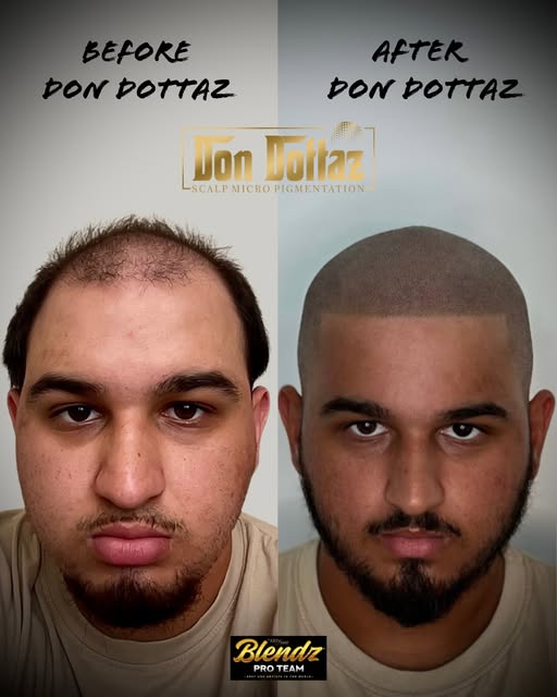 BEFORE & AFTER SMP🪄✨
1ST SESSION RESULTS.

THIS GENTLEMAN GOT IN SHAPE AND TRANSFORMED HIS APPEARAN