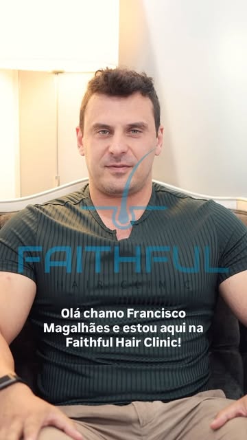 Nada melhor que dar o testemunho na primeira pessoa! Transplante Capilar realizado por Médicos com m