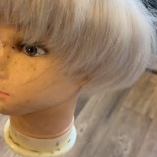 ✨ Bespoke Frontal Hair Replacement at Escape Hair Loss Clinic ✨

Frontal Fibrosing Alopecia (FFA) is