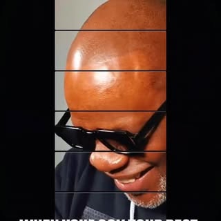 Feeling confident often starts with how you feel about your appearance. A refined hairline can make 