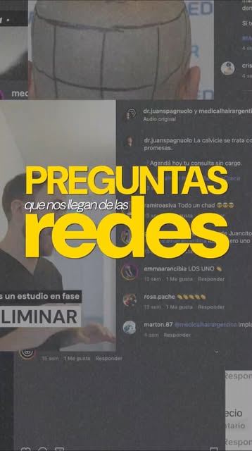 Ustedes preguntan y nosotros respondemos. Hoy aclaramos una de las mayores dudas en relación al sham