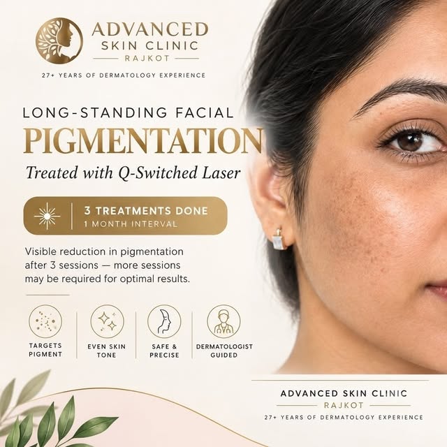 When long-standing pigmentation doesn’t respond adequately to medical treatment…

This clinical case