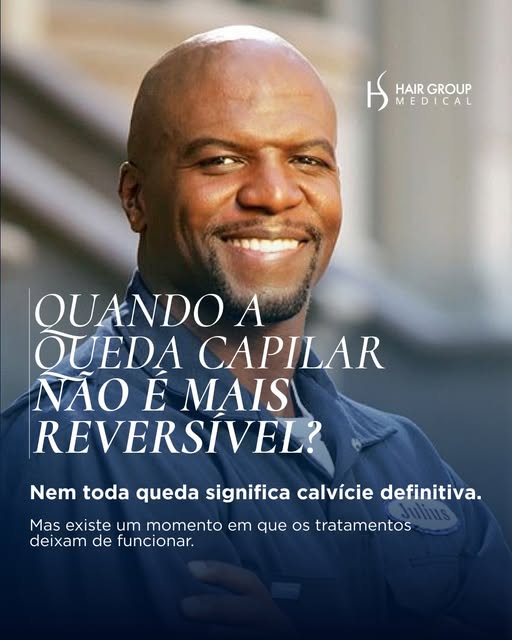 Nem toda queda é definitiva. Mas quando o folículo perde sua capacidade de produzir fios, o tratamen