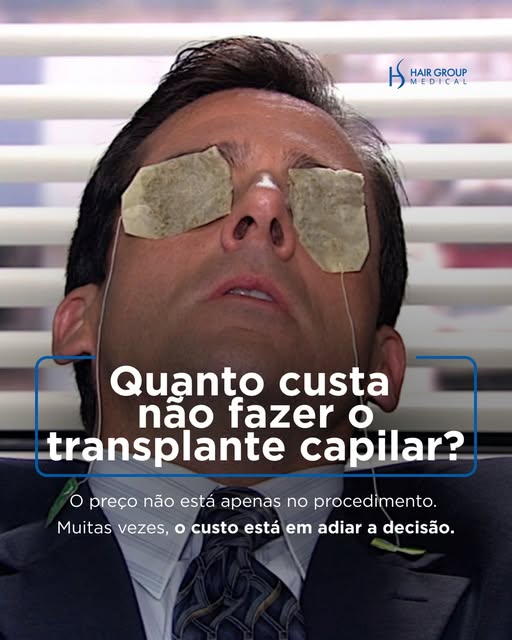 Quanto custa não fazer o transplante capilar?

Às vezes, o maior custo não está no procedimento, mas