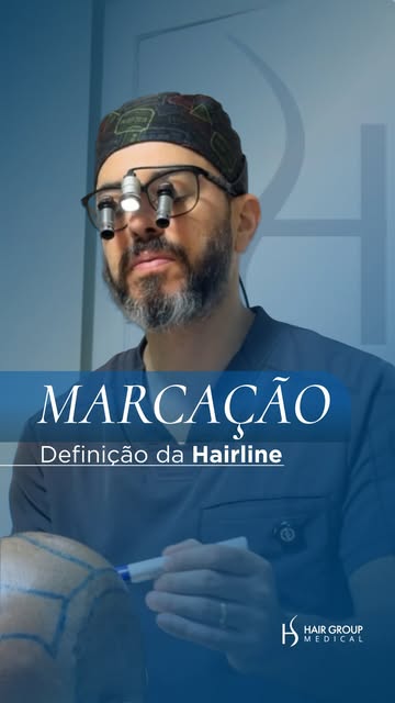 A linha frontal não é desenhada seguindo um padrão. Ela é planejada para cada paciente, considerando