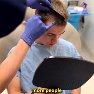 Nick’s hair transplant journey with Dr. Linkov has been unfolding over the last 12 months, and today