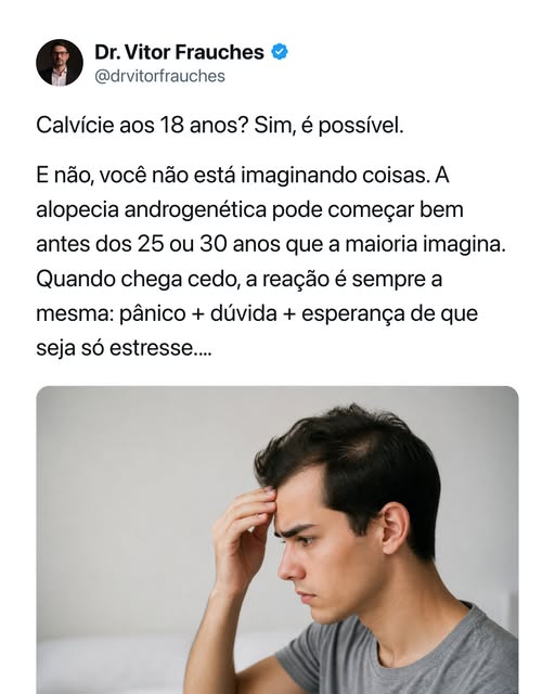 Calvície aos 18 anos é possível. E quando chega cedo, muda tudo.

Não é a norma, mas qualquer tricol