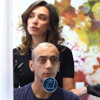 Un patient français nous a fait confiance pour sa greffe de cheveux ✨
Dans cette vidéo, découvrez le