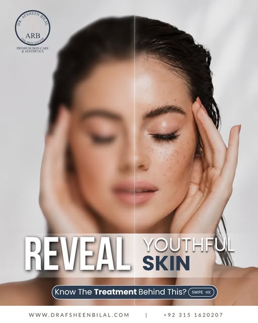 What if your acne scars could get a serious skin upgrade? 

Meet Alma Hybrid CO₂ Laser, an advanced 