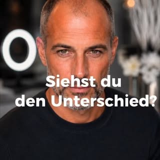 👀 SIEHST DU DEN UNTERSCHIED?

Viele Männer leiden unter Geheimratsecken, lichtem Haar oder kahlen S
