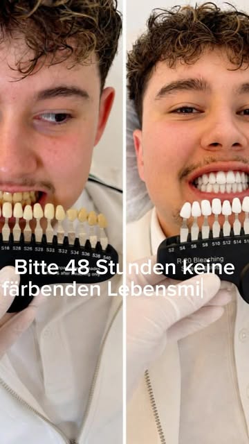 🚨 „48 STUNDEN KEIN ROTWEIN!“ – 2 STUNDEN SPÄTER… 🍷😂

Ich: „Bitte nach dem Zahnbleaching 48 Stunde