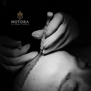 🔎 Discover 𝗙𝗨𝗘: your path to natural hair transformation!

Tehnica #Fue este alegerea preferată 