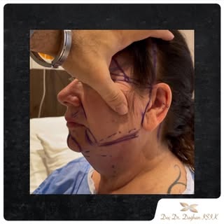 We thank our beloved patient for sharing her surgery result. We are more than happy to have this jou