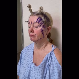 When this beautiful woman first visited my clinic, I noticed how tired she looked. I dedicated my ti