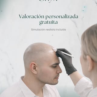 Antes de decidir, lo más importante es valorar 🌟 tu caso de forma personalizada.

En Onyx realizamo
