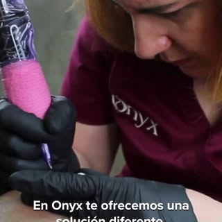 La micropigmentación capilar no es un tatuaje.
Trabajamos en una capa superficial de la piel con pig