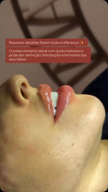 ❤️OS DETALHES❤️ Sempre a soma dos detalhes fazem a diferença. Um lábio bem preenchido e hidratado fa