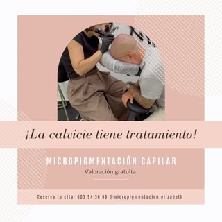 ¿Tienes problemas de calvicie? ¿Buscas una solución duradera y sin ningún tipo de mantenimiento? Llá