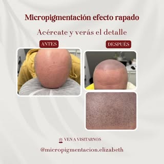 Efecto rapado de nuestro cliente. Si tú también quieres un cambio ahora que comienza el verano no du