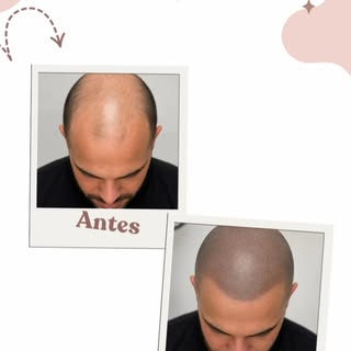 ¡No lo dejes escapar! Renueva tu imagen desde la primera sesión. Ponte en contacto con nosotros y re