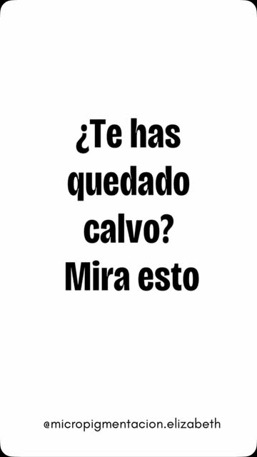 ¿Te has quedado calvo? ¿Te falta densidad? Escríbeme por privado y te explico como solucionar tu pro
