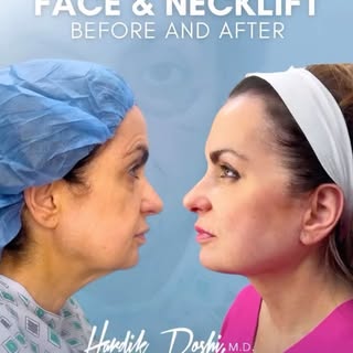 👨‍⚕️ As a facial plastic surgeon, one of the most rewarding aspects of my practice is helping patie