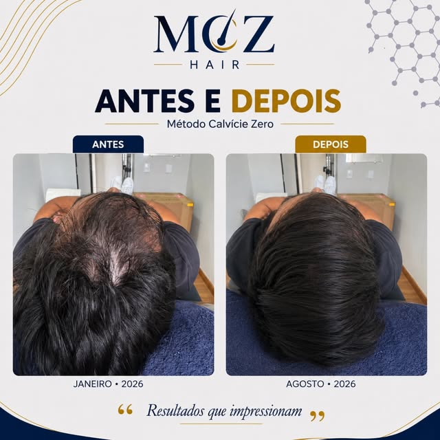 Como não amar esses resultados? 😍