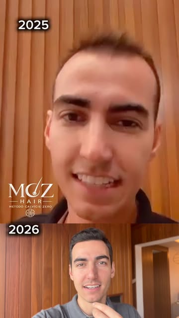 Resultados falam por si só 😍

BUGANZA não acreditava que seria possível recuperar os cabelos sem tr