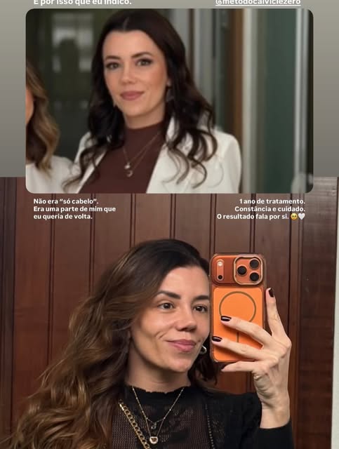 Simplesmente sensacional a quantidade de cabelo que aumentou ❤️❤️! Viva o Método Calvície Zero 🙏🙏
