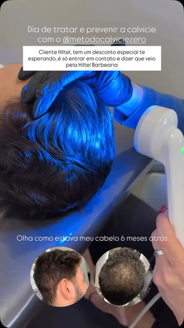 Mais um para vc ter a certeza e tomar a decisão de iniciar seu tratamento @metodocalviciezero