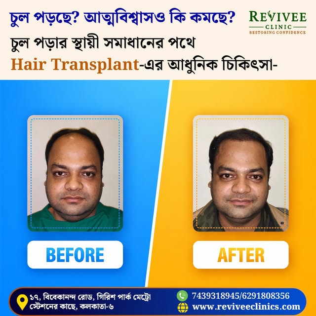 চুল পড়া কি আত্মবিশ্বাস কেড়ে নিচ্ছে?

🌿 ফিরিয়ে আনুন চুল, ফিরিয়ে আনুন আত্মবিশ্বাস!
আধুনিক Hair Tr