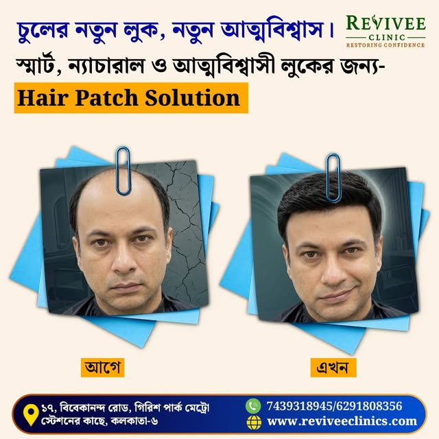 চুলের নতুন লুকে ফিরুক আপনার আত্মবিশ্বাস! 💙
টাক বা পাতলা চুলের দুশ্চিন্তা নয়—
Smart, Natural & Confi