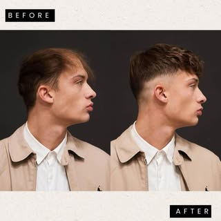 Michael is so happy about his new hair replacement! ❤️ 
Book your free consultation today! 💇‍♂️ #lu