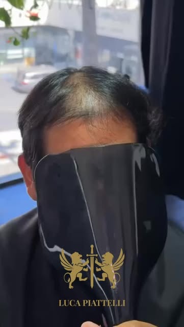 Do you like it? Comment to know more👇🏻

#lucapiattellidubai #hairreplacement #hairreplacementsyste