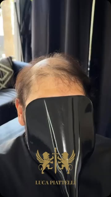Do you like it? Comment to know more👇🏻

#lucapiattellidubai #hairreplacement #hairreplacementsyste