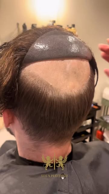 Do you like it? Dm me to know more💪🏻

#lucapiattellidubai #hairreplacement #hairreplacementsystem 