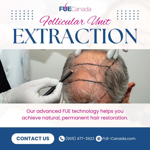 Follicular Unit Extraction, done with precision. Advanced technology, natural results, and a team th