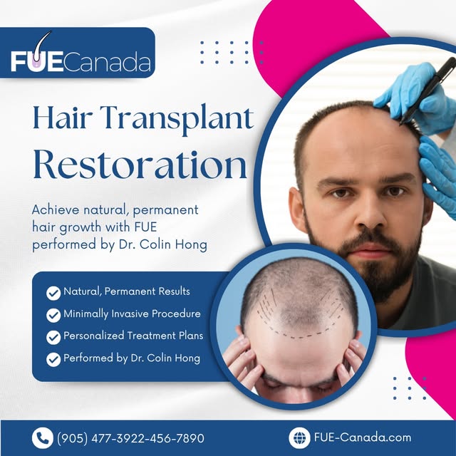 Every strand tells a story of confidence restored. Our FUE technique extracts and places follicles w