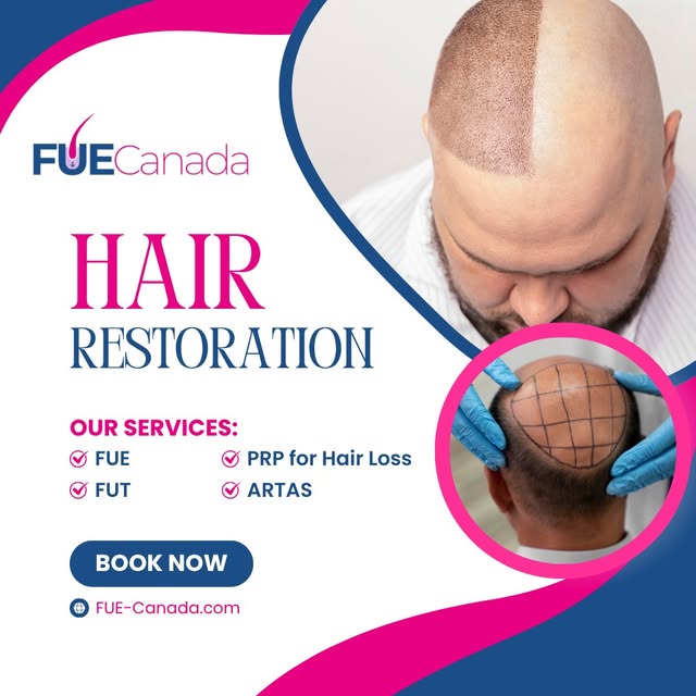 FUE. FUT. PRP. ARTAS. Whatever stage of hair loss you're at, we have a solution built around you.
Ex