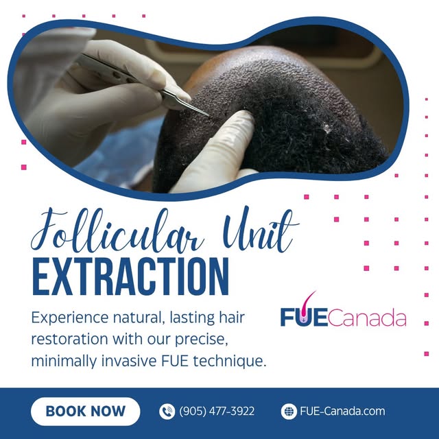 Precision, follicle by follicle. This is what advanced FUE looks like in action, and it's how we del