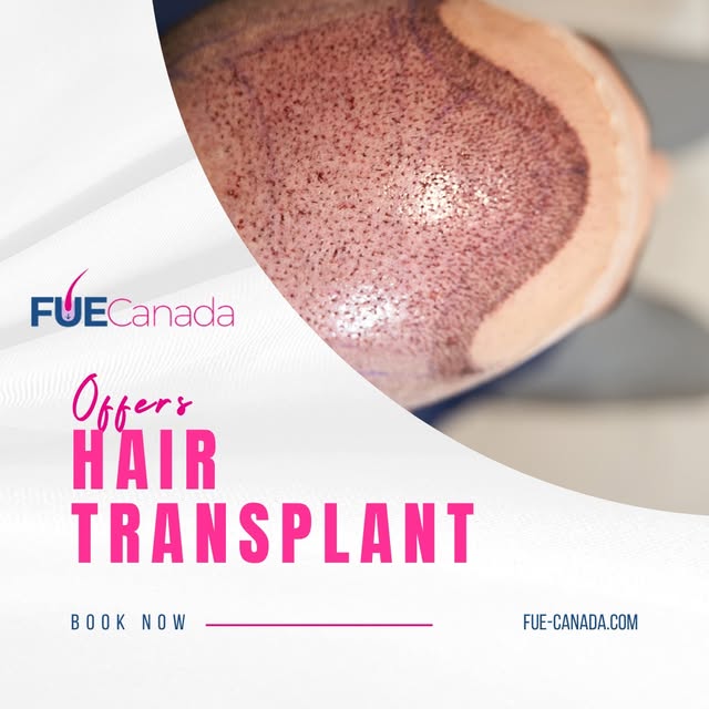 Ready to explore your hair restoration options? Our team is here to walk you through what's possible