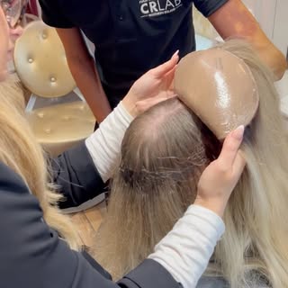 🌟𝐓𝐡𝐞 𝐟𝐮𝐭𝐮𝐫𝐞 𝐨𝐟 𝐡𝐚𝐢𝐫 𝐬𝐨𝐥𝐮𝐭𝐢𝐨𝐧𝐬 𝐢𝐬 𝐡𝐞𝐫𝐞 🌟

At Hair Loss Rehab, we’re r