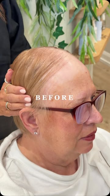 ✨ A beautiful transformation for Jackie ✨

A natural, flattering result designed to restore confiden
